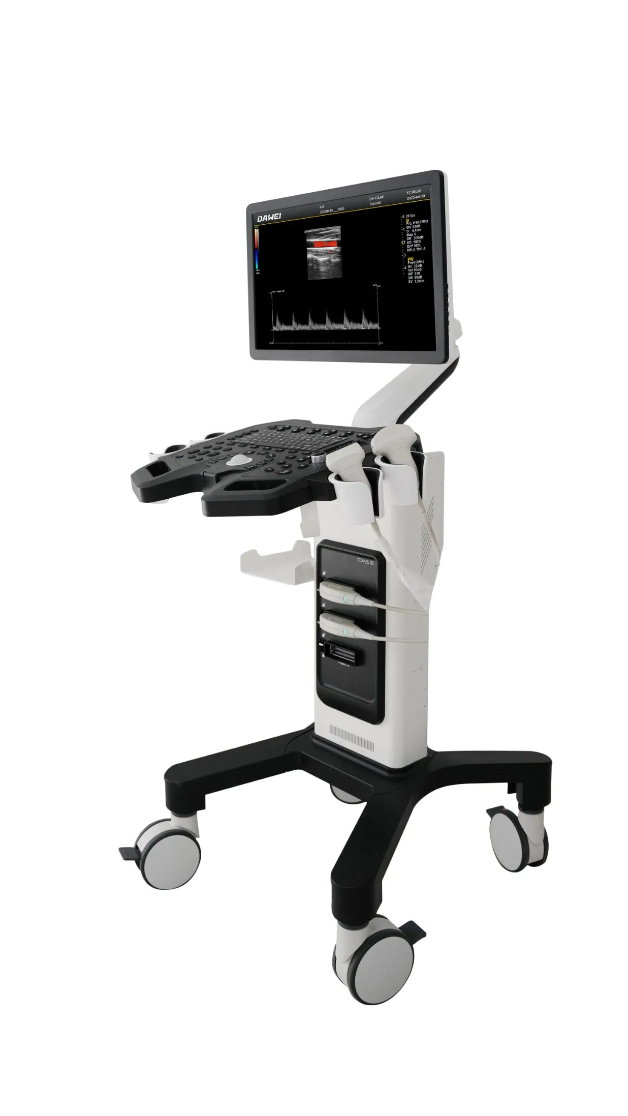 Carro médico de ultrasonido Doppler vascular