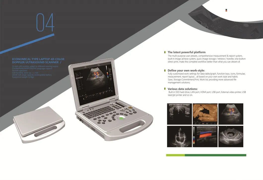 Sistema de Diagnóstico Ultrasonido Digital Completo para Laptop Cy-580