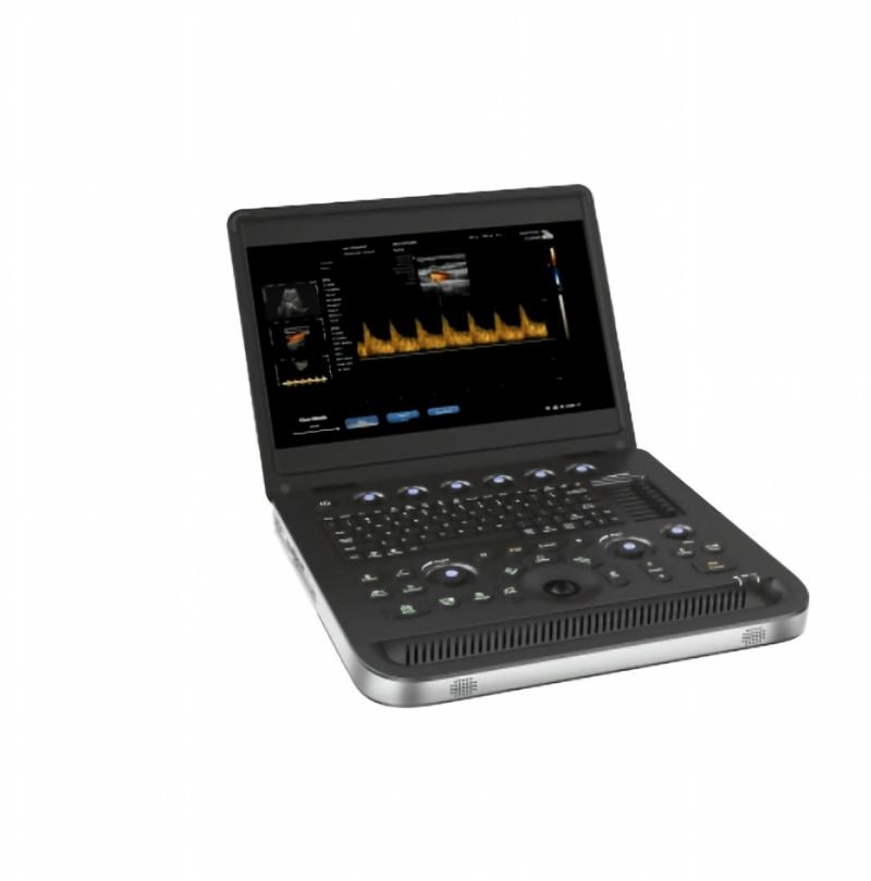 Máquina de ultrasonido portátil versátil para aplicaciones pediátricas