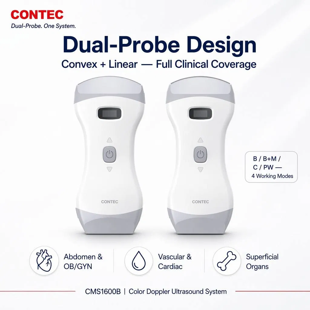 Contec Cms1600b Escáner de ultrasonido portátil inalámbrico con sonda Doppler color aprobado por Salud Canadá