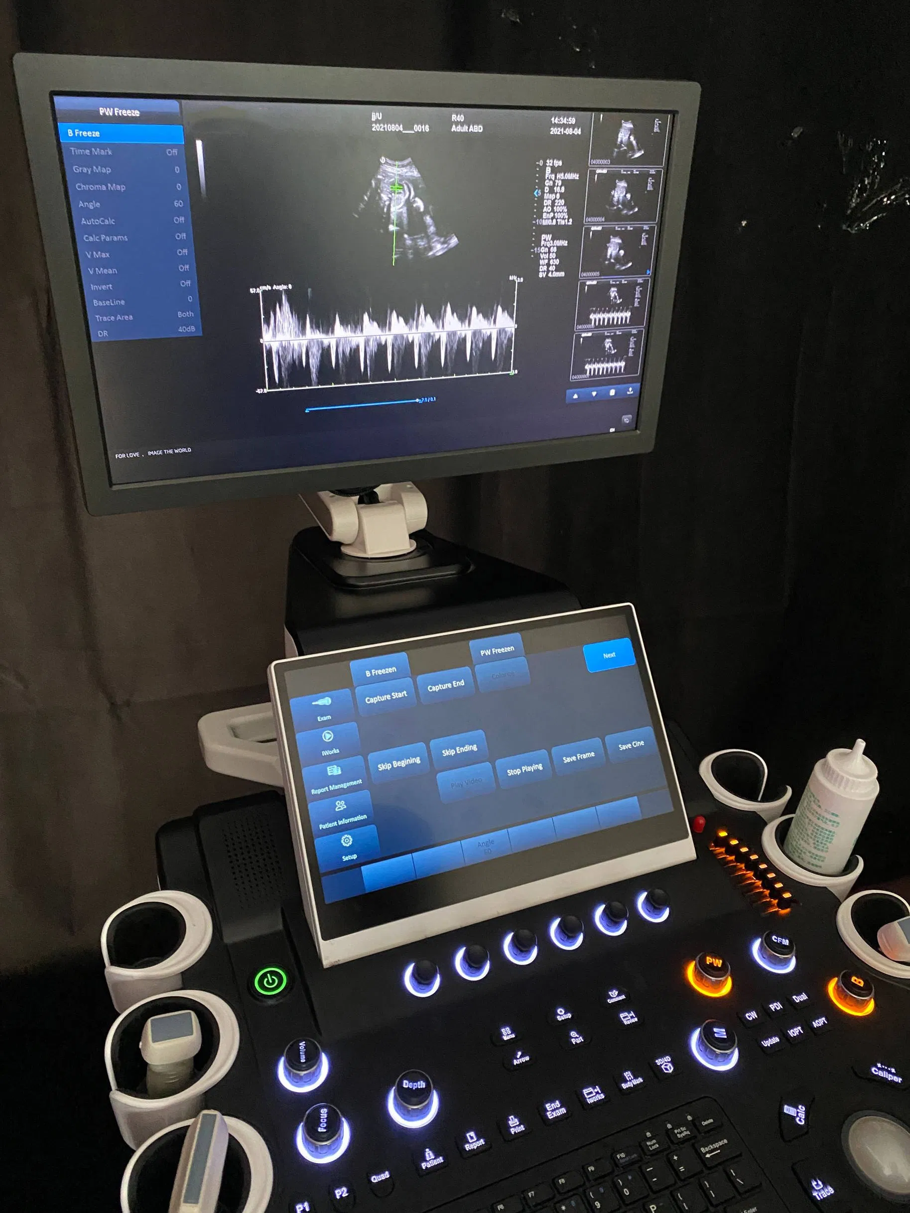 Instrumentos médicos profesionales de ultrasonidos con aprobación CE e ISO 3D 4D 5D máquina de ultrasonido Doppler color Trolley