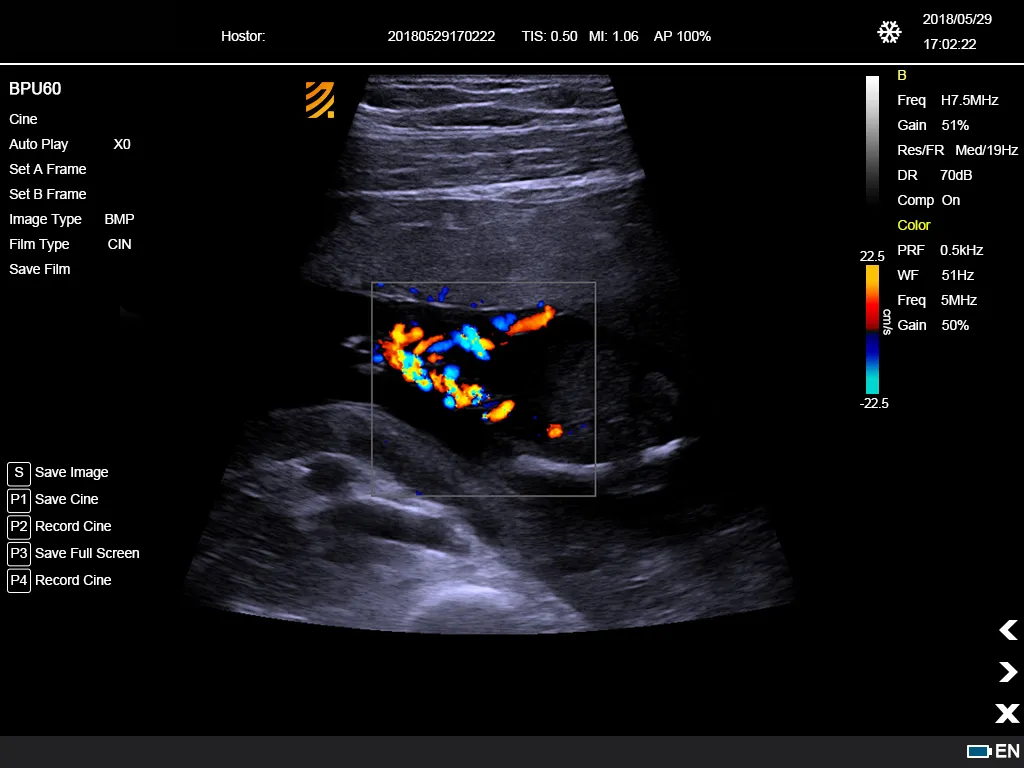 Ultrasonido Doppler Color 9