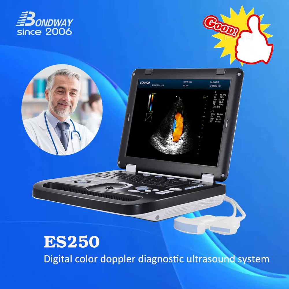 3D/4D Sistema de Imagen Ultrasonido Doppler Color, Sonografía Digital con Pantalla LED Médica Grande