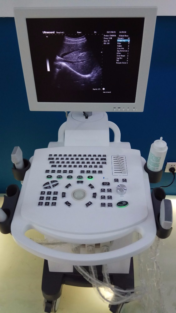 Carro de equipo hospitalario B/N máquina de ultrasonido para humanos (THR-US370)