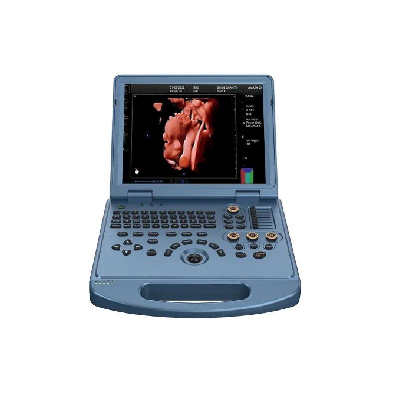 Sistema de Ultrasonido Doppler
