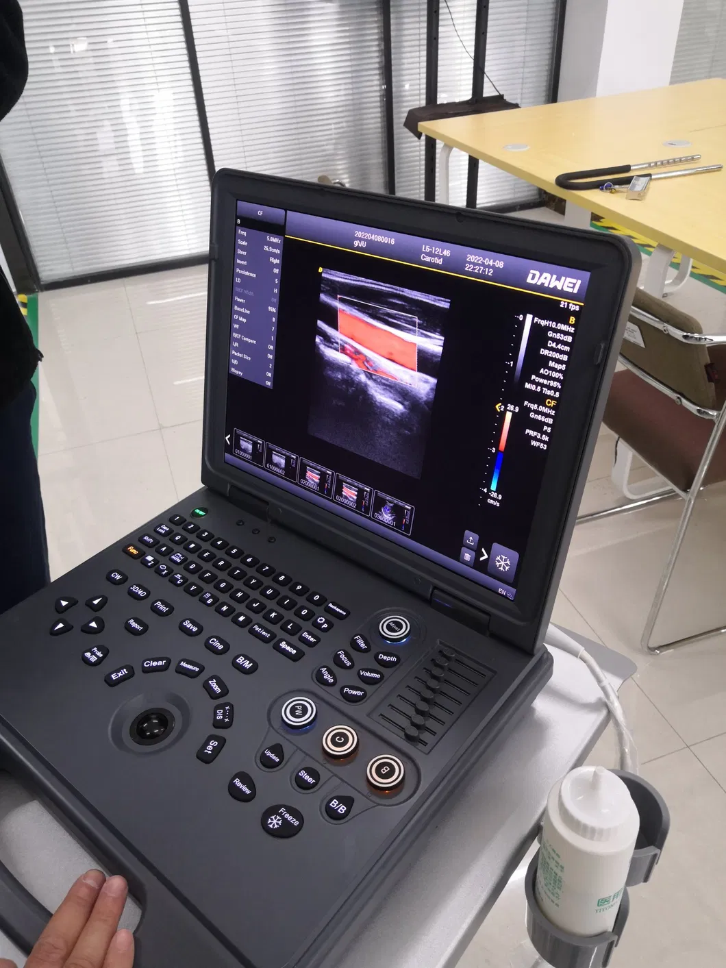 Precio de fábrica Hospital Médico Portátil Laptop 2D 3D 4D Escáner de Ultrasonido Doppler Color Máquina