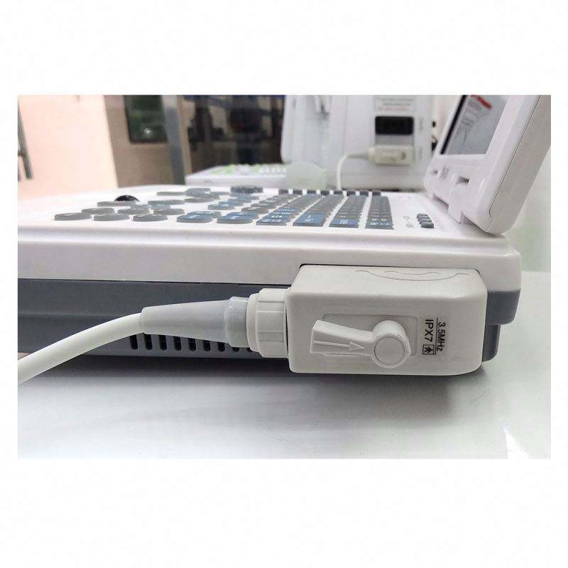 Escáner ultrasónico diagnóstico portátil humano obstétrico ginecológico barato para laptop