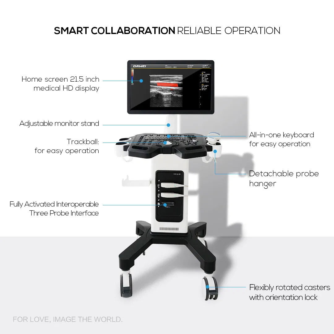 Carro médico de ultrasonido Doppler vascular