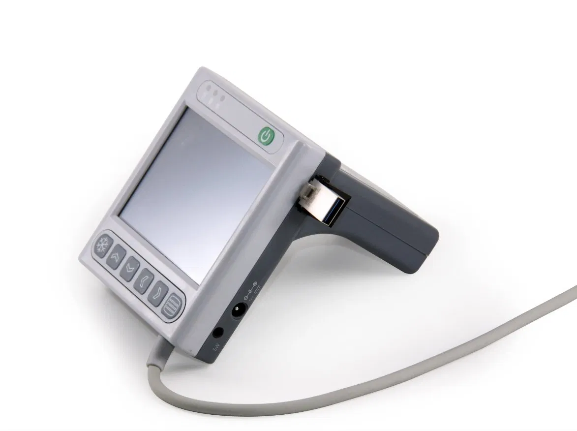 Escáner de ultrasonido de vejiga portátil, sistema de escaneo de volumen de vejiga
