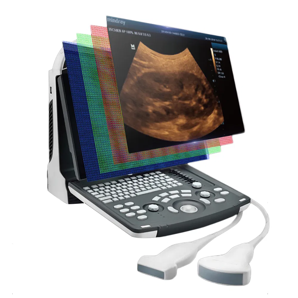Ultrasuono Portátil DP-30 Diseño