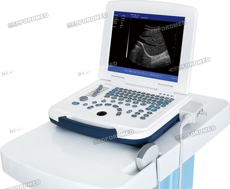 Máquina de Ultrasonido Médico en Blanco y Negro Sistema de Diagnóstico Ultrasonico Me-580 W1.0