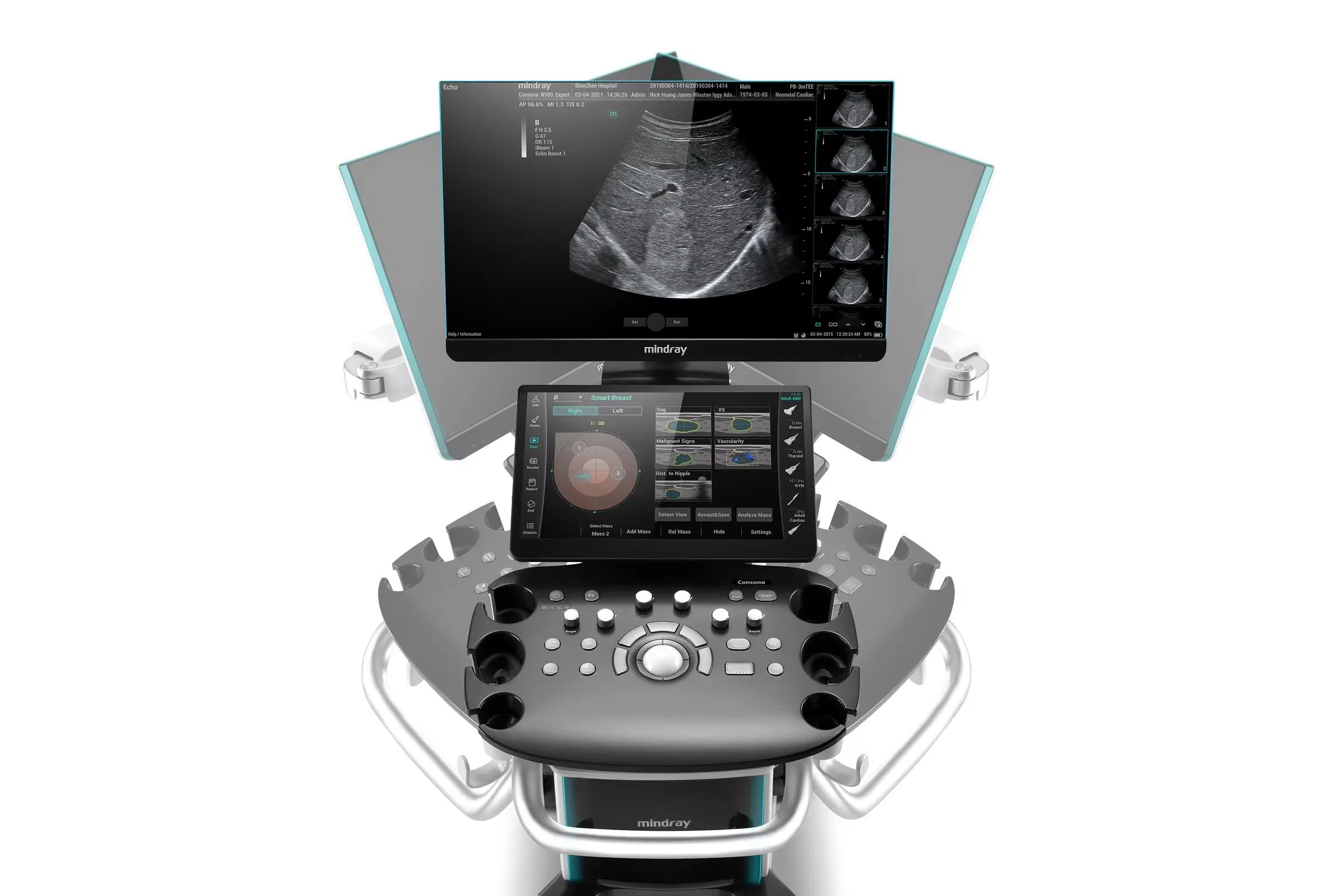Máquina de ultrasonido Doppler color cardiovascular obstétrico ginecológico Mindray Consona N6 N7 N8 N9 de alta venta
