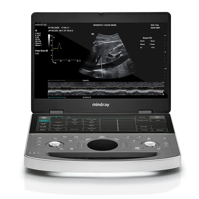 Mindray ME Series 5