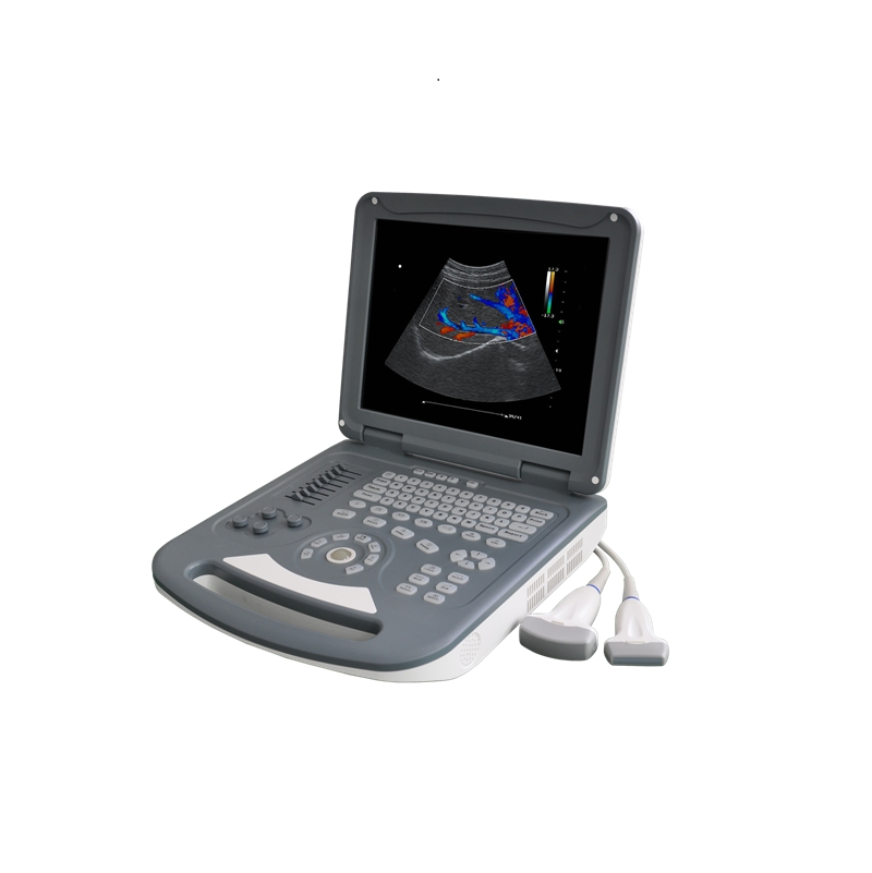 Umus067 Sistema de Ultrasonido Doppler Color Portátil-- Imágenes Avanzadas para Diagnósticos Comprensivos