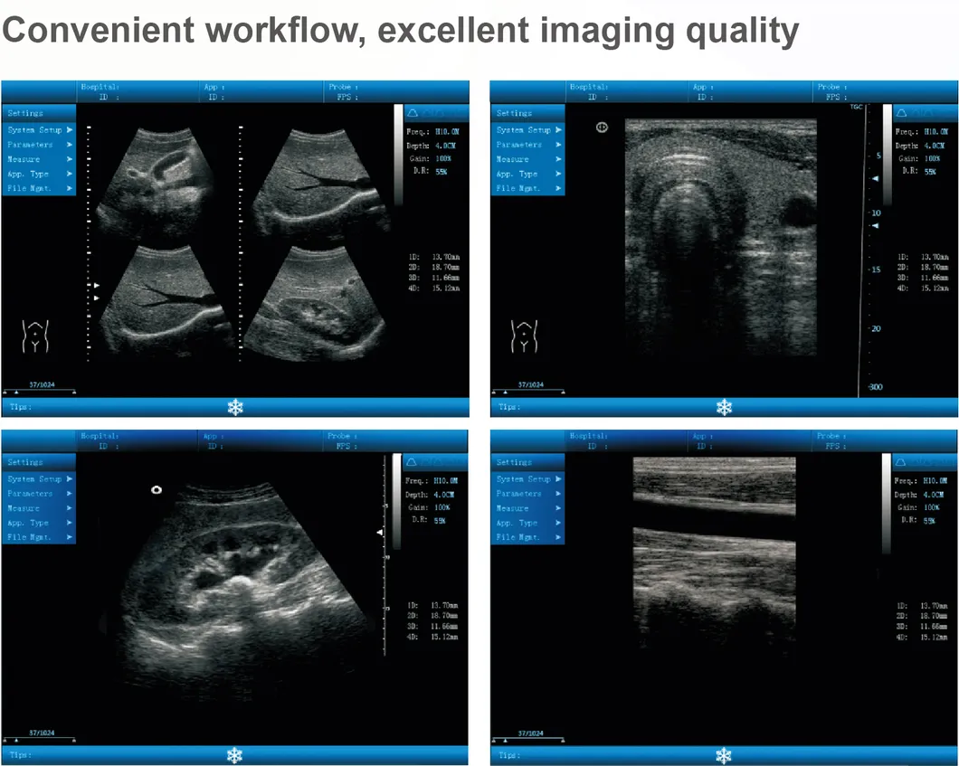 Imagen Médica Ultrasonido
