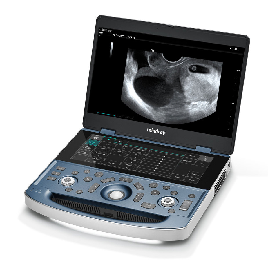 Mindray MX7 Máquina de Ultrasonido Digital de Alto Costo Efectivo 3D Máquina de Ultrasonido Doppler Color