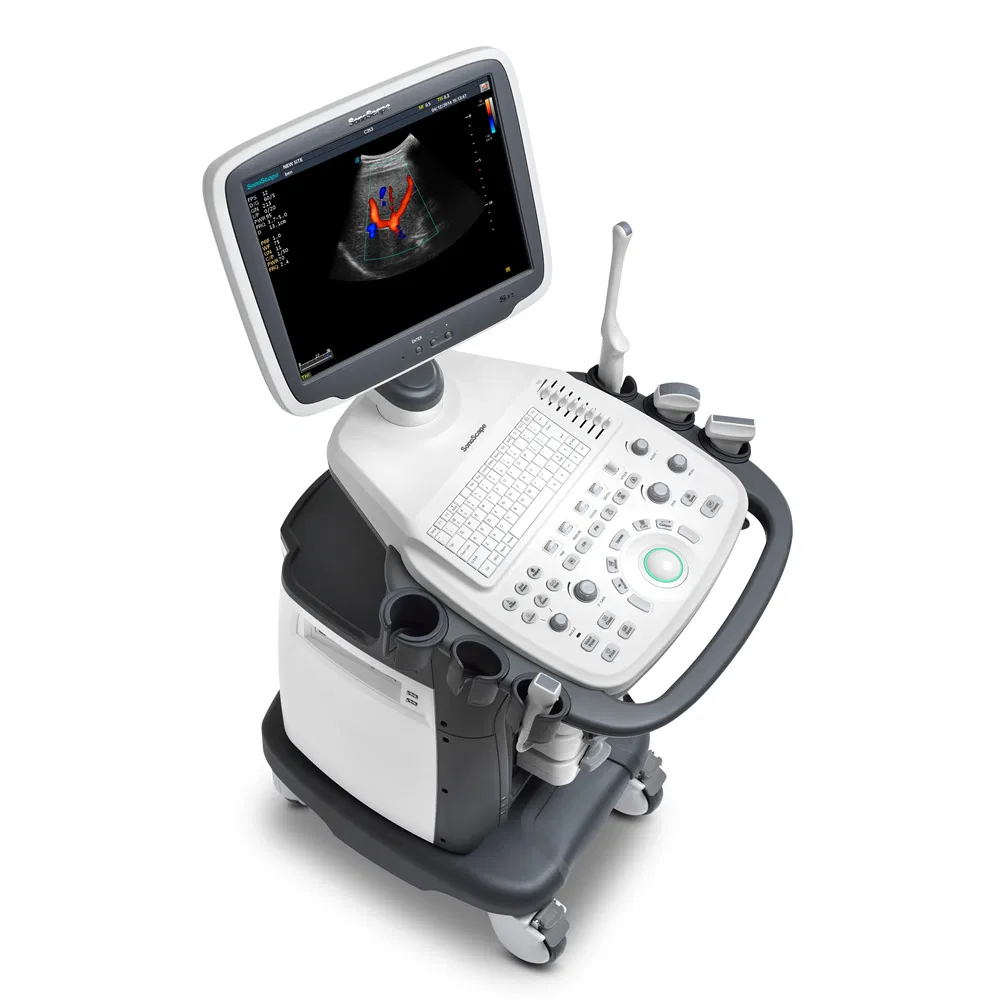 S12 Móvil Médico 3D/4D Máquina de Ultrasonido Doppler Color
