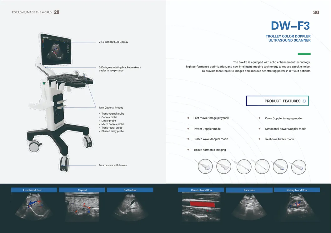 Carro médico de ultrasonido Doppler vascular