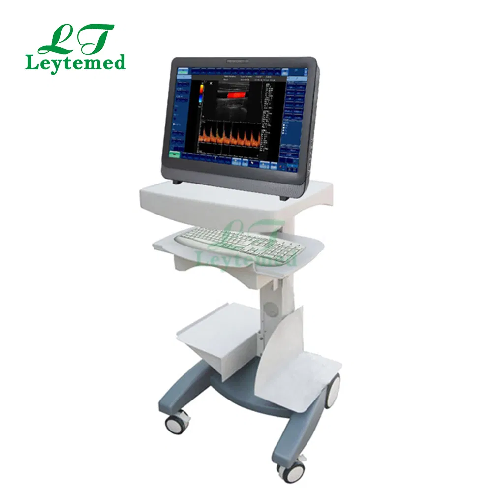 Ltub05 Sistema de Ultrasonido Doppler Color Portátil 12' Pulgadas