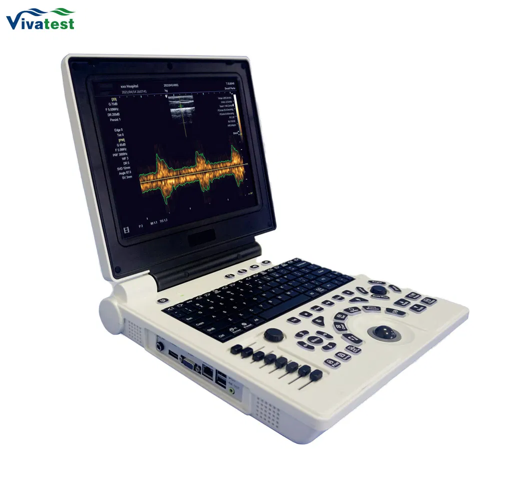 Diagnóstico por ultrasonido Doppler 4
