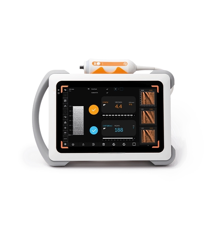 Máquina de examen de hígado de ultrasonido Fibroscan Mini Plus no invasiva de alta gama