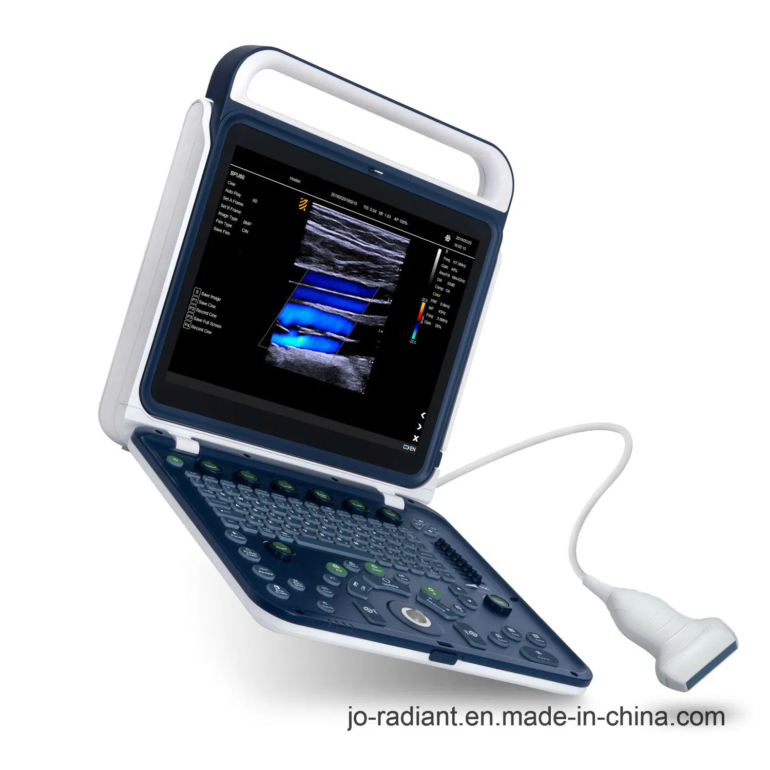 Sistema de escáner ultrasónico Doppler color portátil