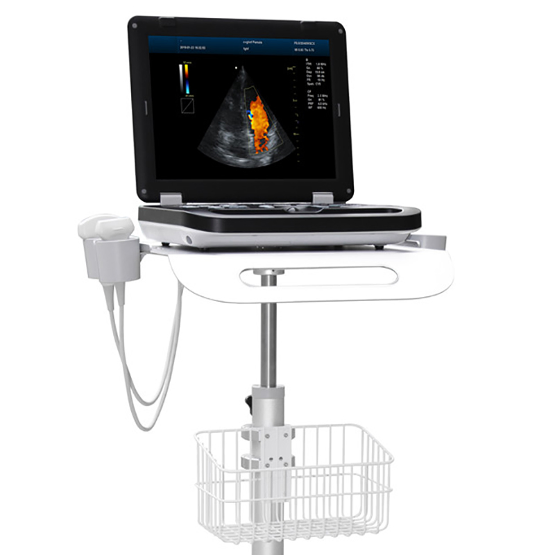 3D 4D Máquina de Ultrasonido Doppler Color Vascular Cardíaco Precio