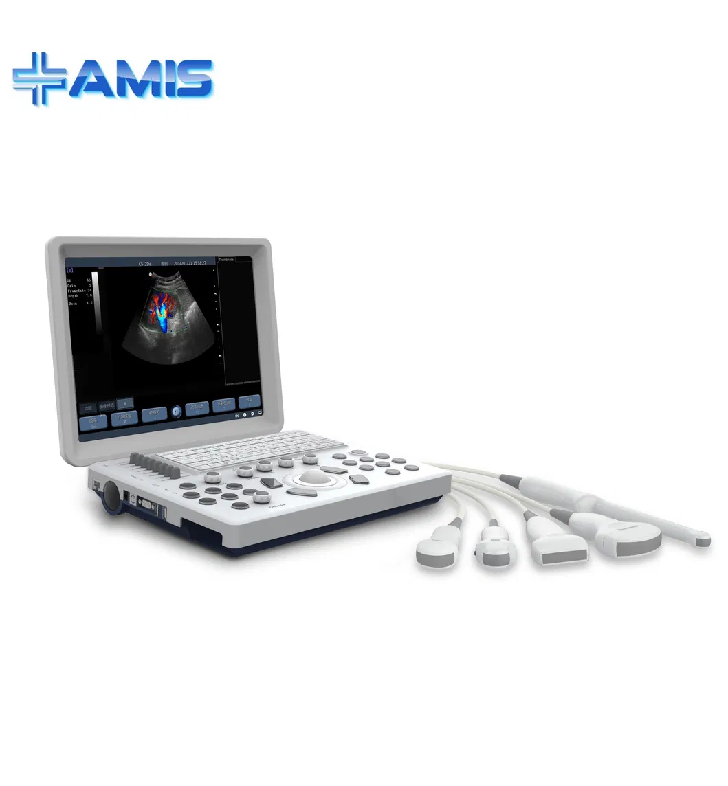 Sistema de diagnóstico por ultrasonido Doppler color digital