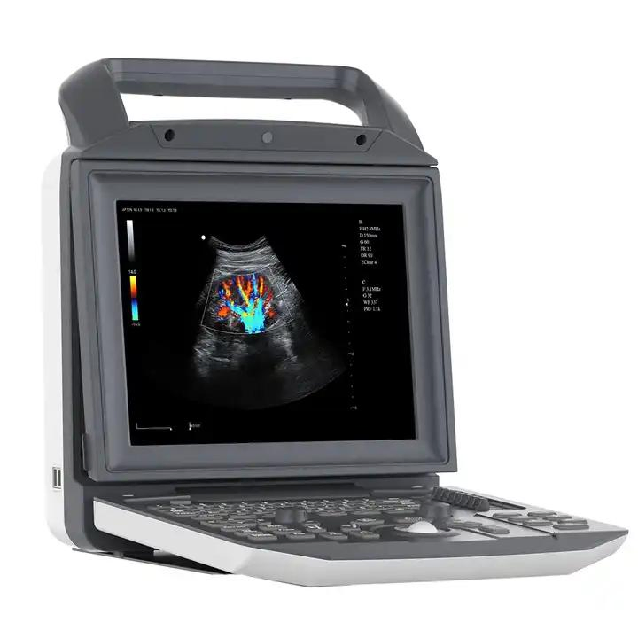 Sistema de escáner ultrasónico portátil de diagnóstico por ultrasonido Doppler color