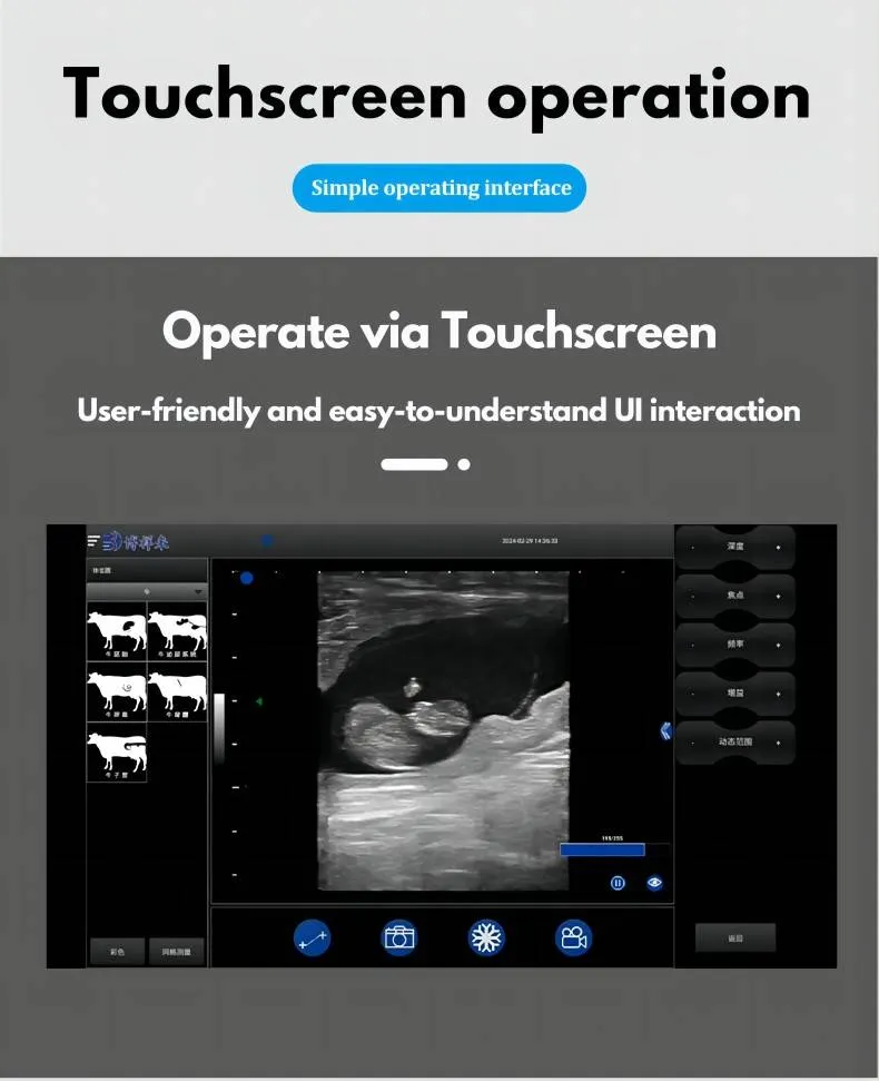 Interfaz de App Ultrasonido