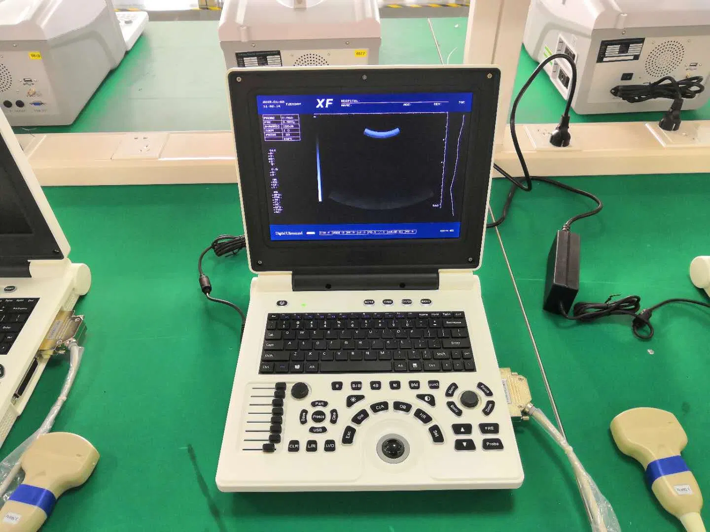 Máquina de escáner ultrasónico portátil Bw para hospital Xf30b con obstetricia y ginecología