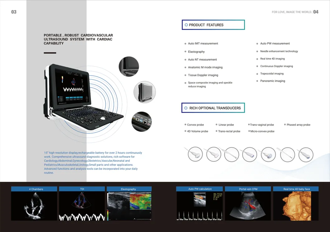 Detalle Ultrasonido 3