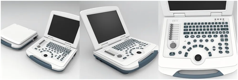 Ultrasonido 6