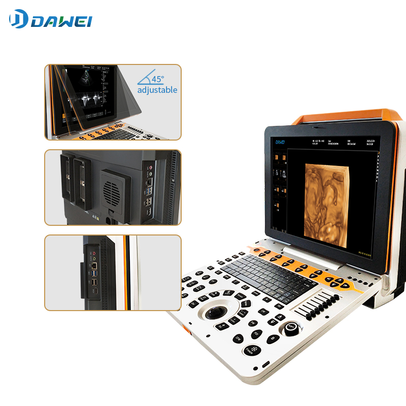 15 Sistema de Ultrasonido Portátil de 8 Pulgadas para Cardiología Abdominal Obstetricia Dw-P60