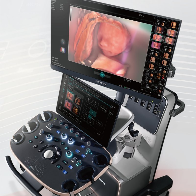 Equipo Hospitalario de Mindray Nuewa I9 Ecógrafo Doppler Color en Obstetricia y Ginecología