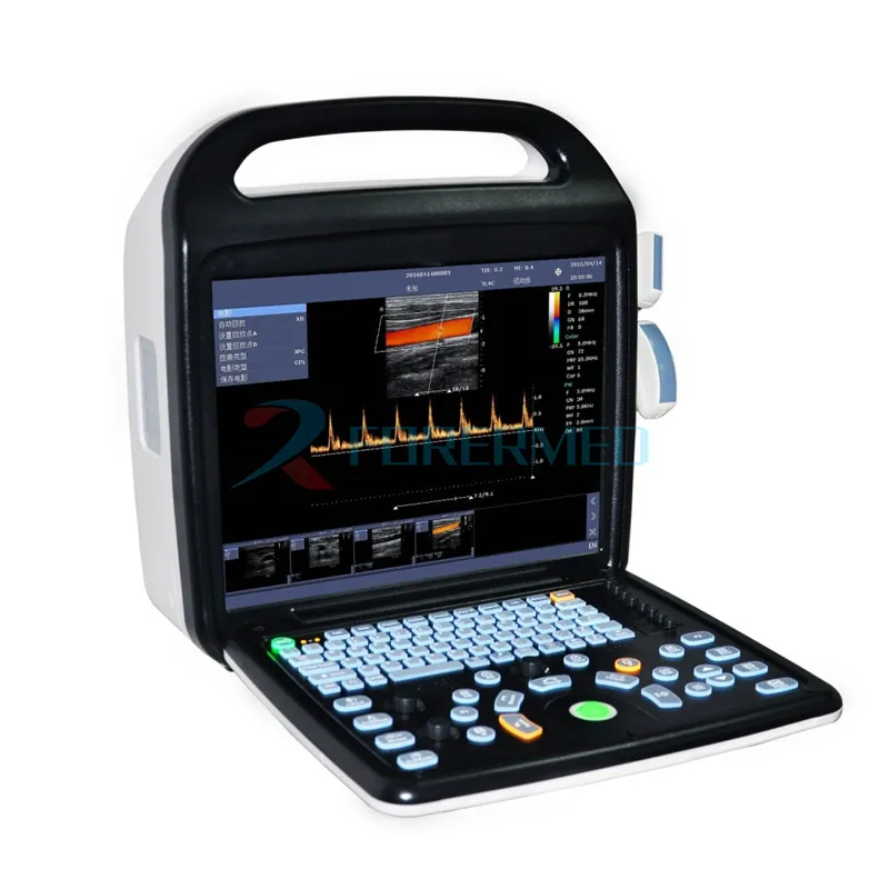 4D Escáner de Ultrasonido