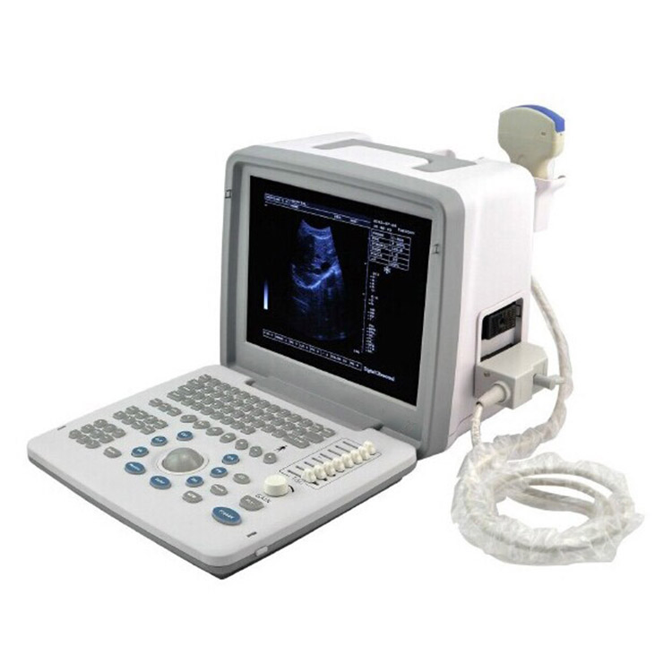 Ubw300 Máquina de ultrasonido portátil humana de bajo precio para instrumentos médicos