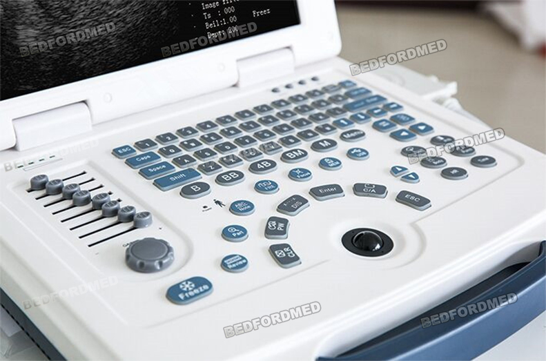 Máquina de Ultrasonido Médico en Blanco y Negro Sistema de Diagnóstico Ultrasonico Me-580 W1.0