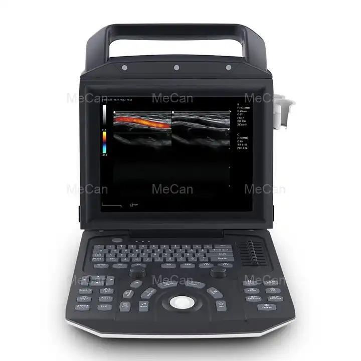 Sistema de escáner ultrasónico portátil de diagnóstico por ultrasonido Doppler color