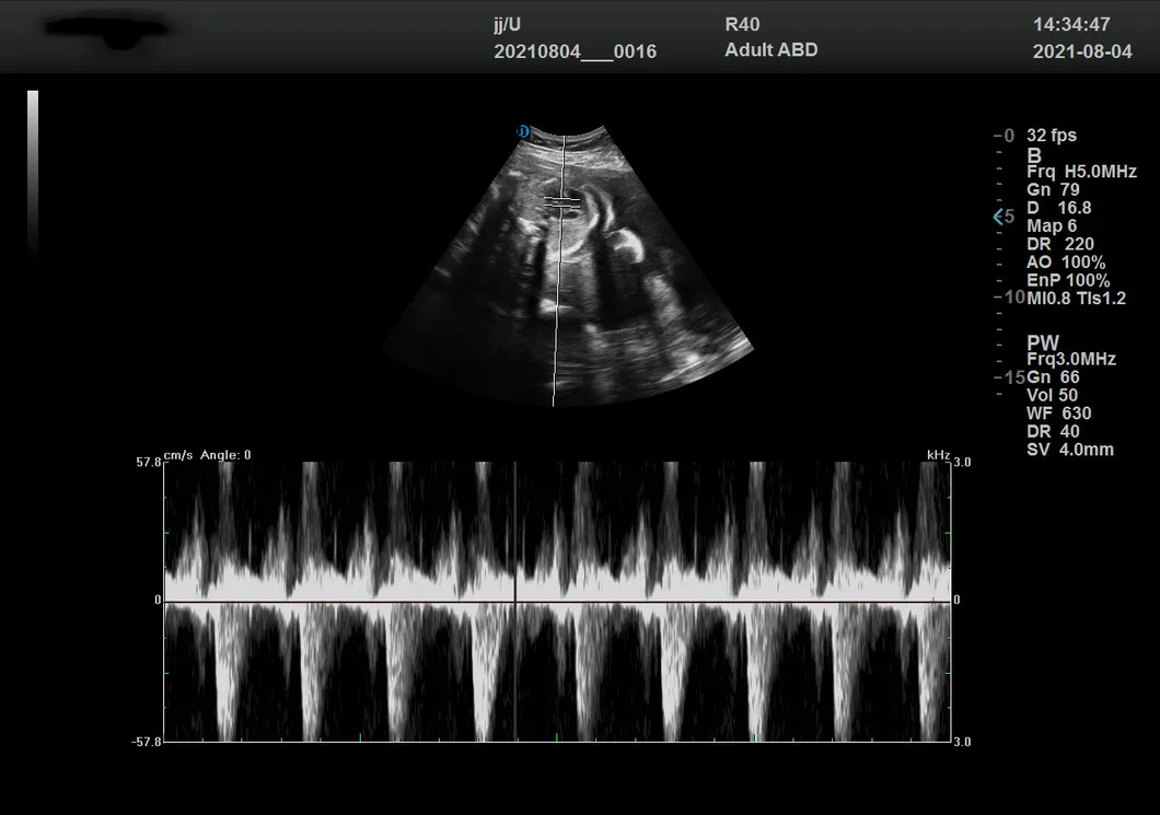 Frecuencia cardíaca fetal