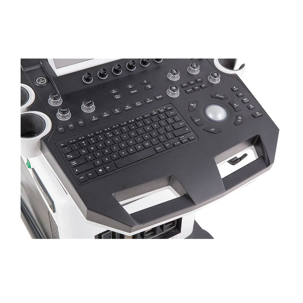 Imagen de ultrasonido 3
