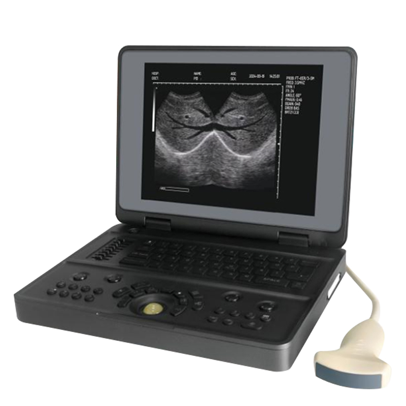 Ysb3000W Equipo de Ultrasonido Médico Portátil Digital Completo Máquina de Ultrasonido en Blanco y Negro