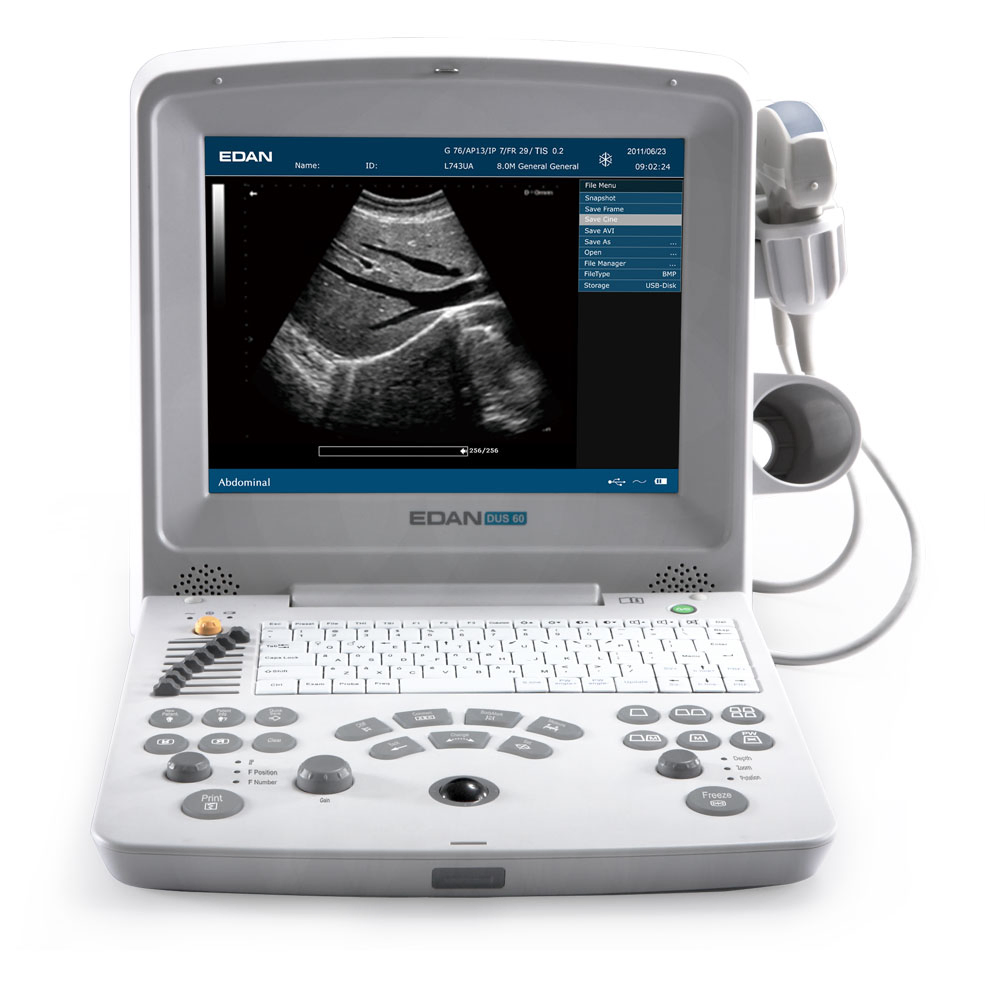 Edan Dus60 Máquina de Ultrasonido Portátil Veterinario en Venta Precio