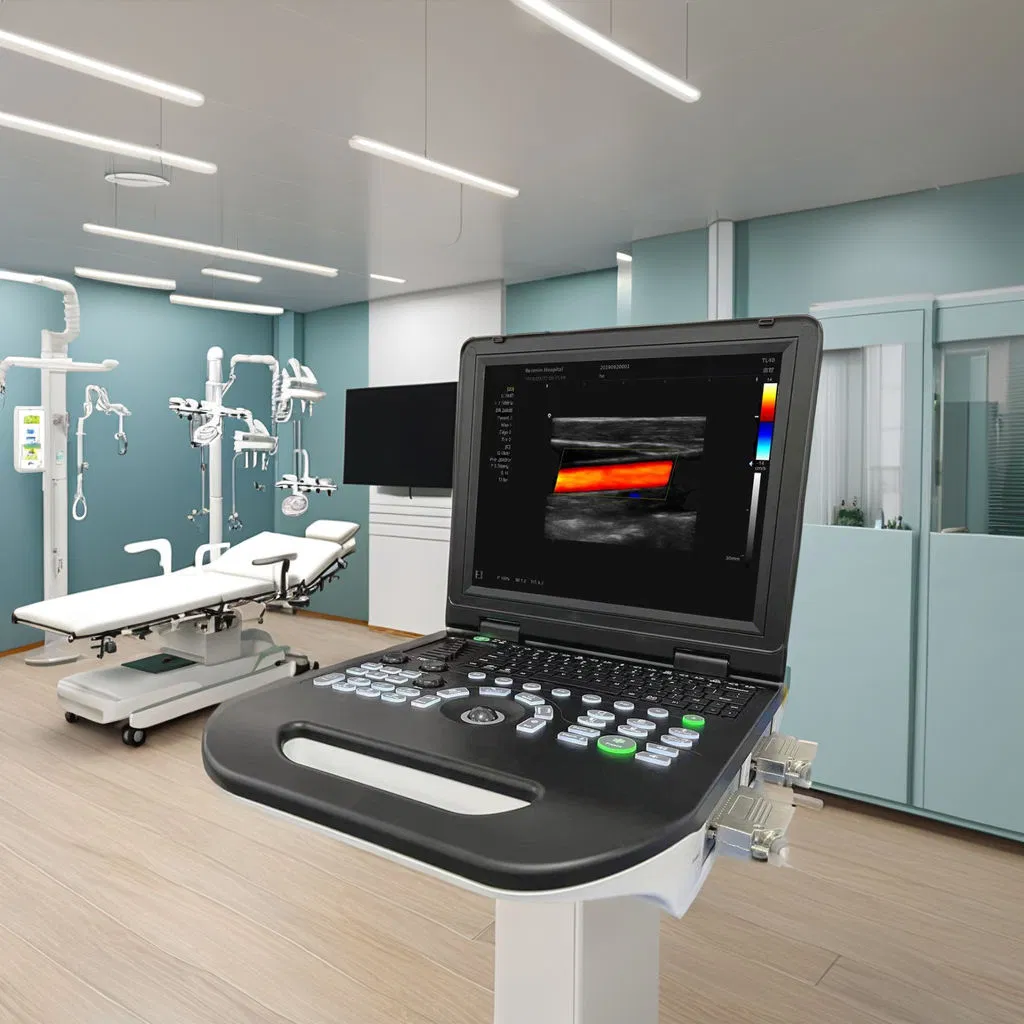 Sistema de Ultrasonido Portátil Doppler Color Ecografía Máquina Veterinaria Totalmente Digital