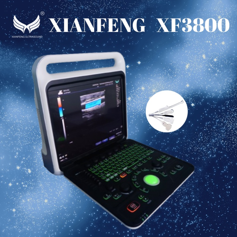 Sistema de Escaneo Ultrasónico Portátil con Doppler Color Digital Completo 3D/4D Máquina de Ecocardiografía