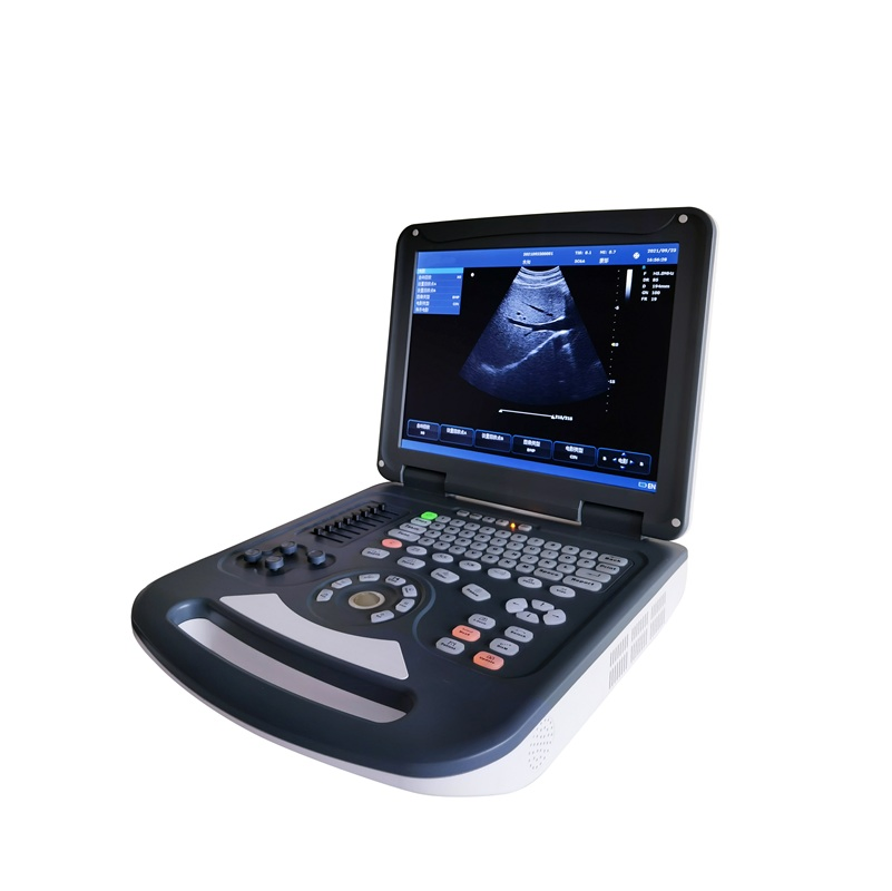 Umus067 Sistema de Ultrasonido Doppler Color Portátil-- Imágenes Avanzadas para Diagnósticos Comprensivos