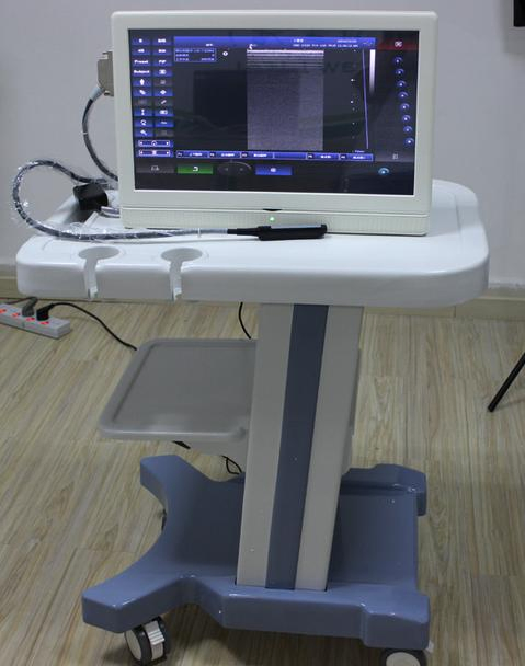 Escáner de ultrasonido portátil de alta frecuencia de diseño atractivo y popular, precio para Msk, nervio vascular 15MHz B36