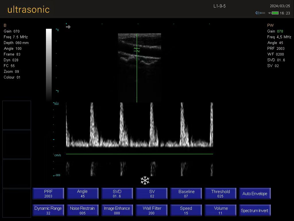 Máquina de ultrasonido veterinario K5 para animales de granja