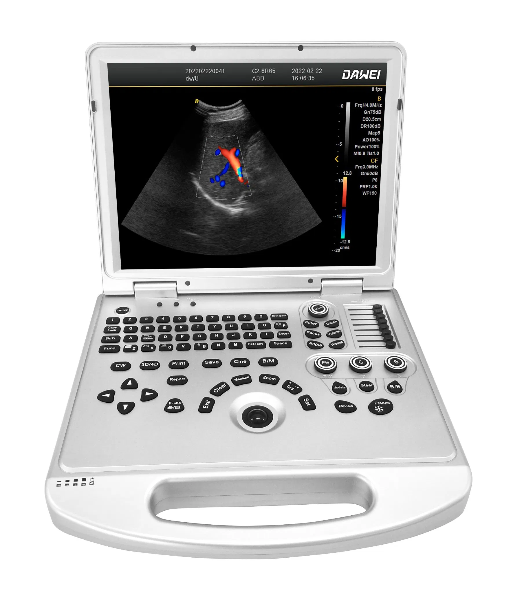 Sistema de Ultrasonido Doppler Color Portátil Dw-L3