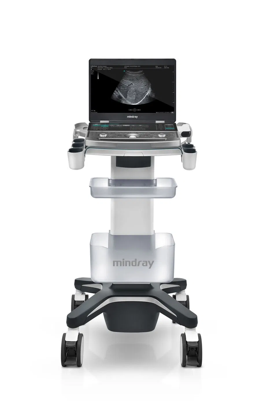 Mindray MX7 Máquina de Escáner Ultrasónico Portátil con Doppler Color 3D 4D